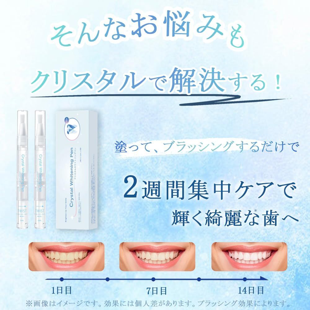 2週間集中ケア:1日目→7日目→14日目で輝く綺麗な歯へ。【効果図】 2週間集中ケア:1日目→7日目→14日目で輝く綺麗な歯へ。【効果図】