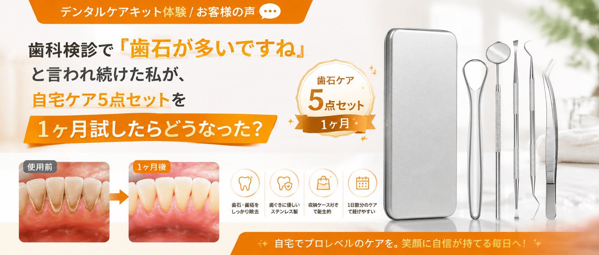 歯科検診で『歯石が多いですね』と言われ続けた私が、自宅ケア5点セットを1ヶ月試したらどうなった？